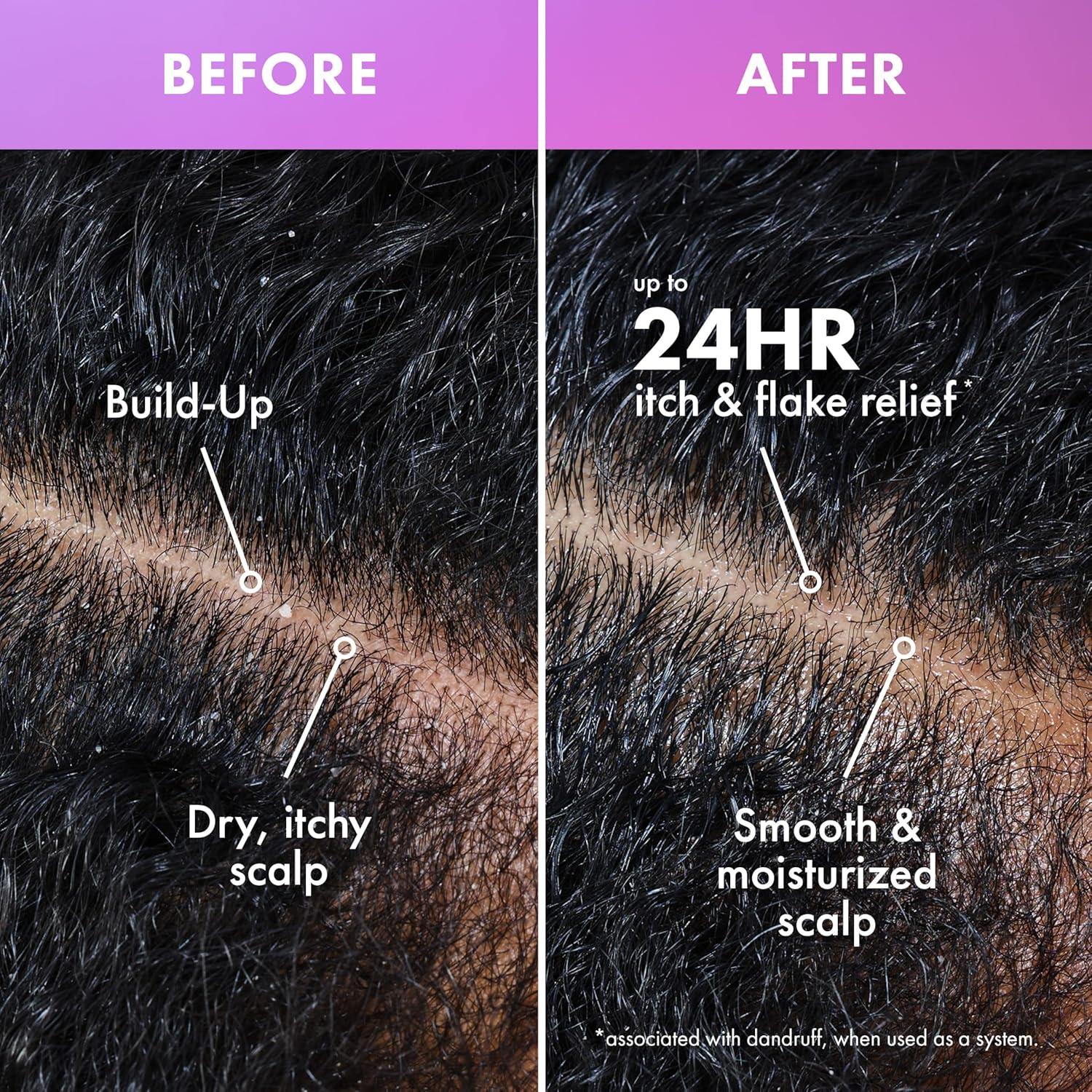 imageMielle Organics Lavender amp Lychee Scalp amp Hair BuildUp Remover Clarifying PreShampoo Treatment for Product Build Up Dirt amp Oil With Niacinamide Castor Oil amp Lavender Extract 4 fl oz